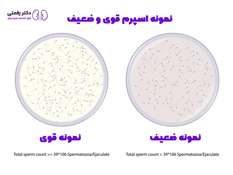 آزمایش ناباروری مردان