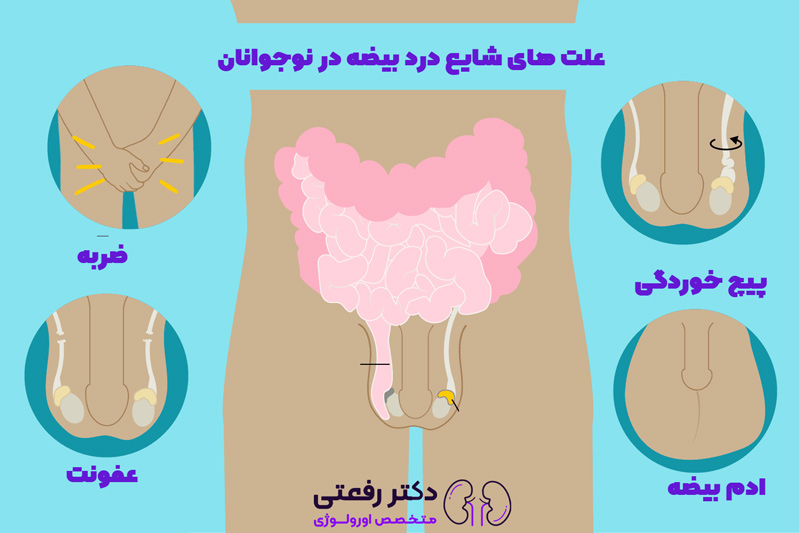 درد بیضه چپ نشانه چیست؟