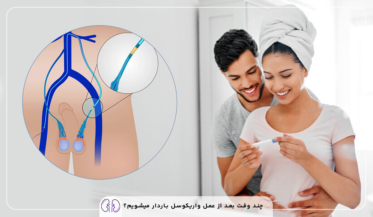آیا بعد از عمل واریکوسل اسپرم قوی میشود؟