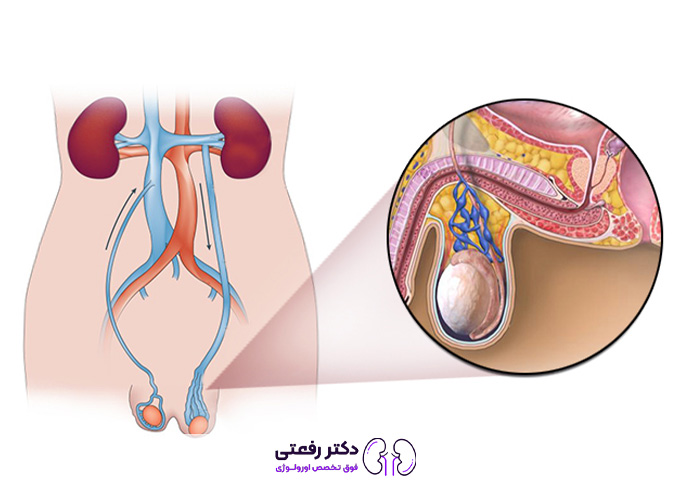 چه چیزی برای درد بیضه خوب است؟