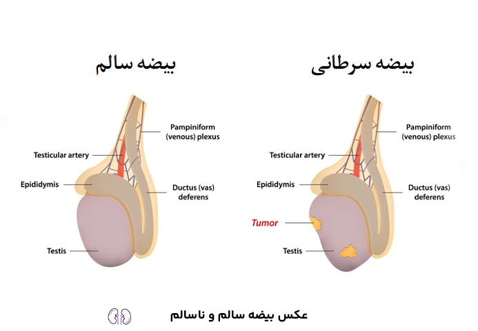 عکس بیضه سالم و ناسالم